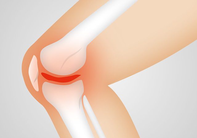 Objawy i leczenie uszkodzonej chrząstki stawowej kolana