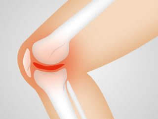 Objawy i leczenie uszkodzonej chrząstki stawowej kolana