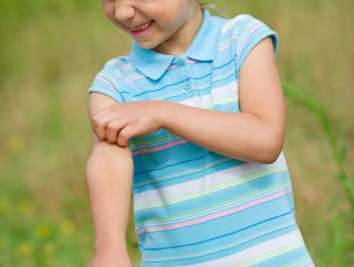 Pokrzywka idiopatyczna – czym jest i jak ją rozpoznać?