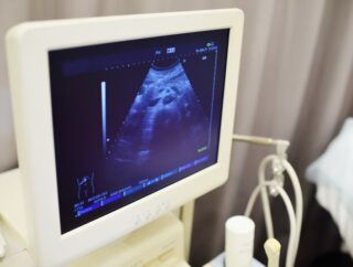 Badanie historii ultrasonografii – od początków do współczesności